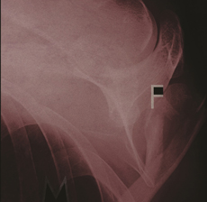 Father Murphy Pain is on Our Side Now